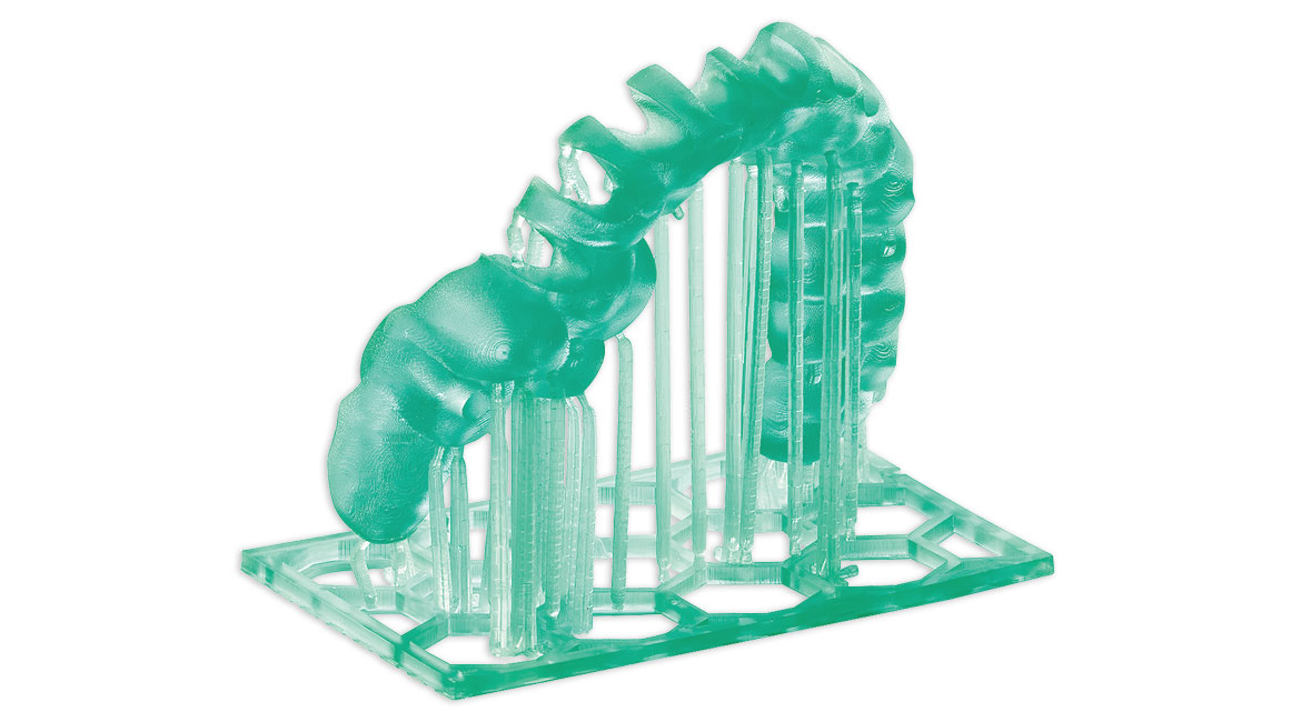 3D-gedruckte sterilisierbare Bohrschablone aus M-PRINT Surgical guide HT mit Supportstrukturen
