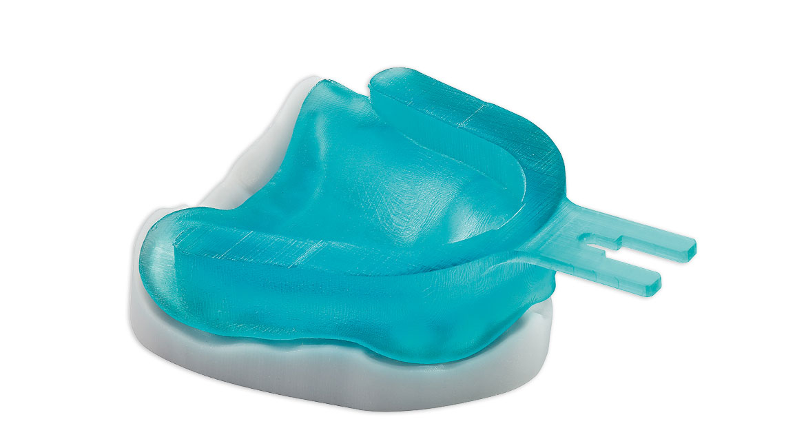 3D-gedruckte Bissnahme aus M-PRINT Tray