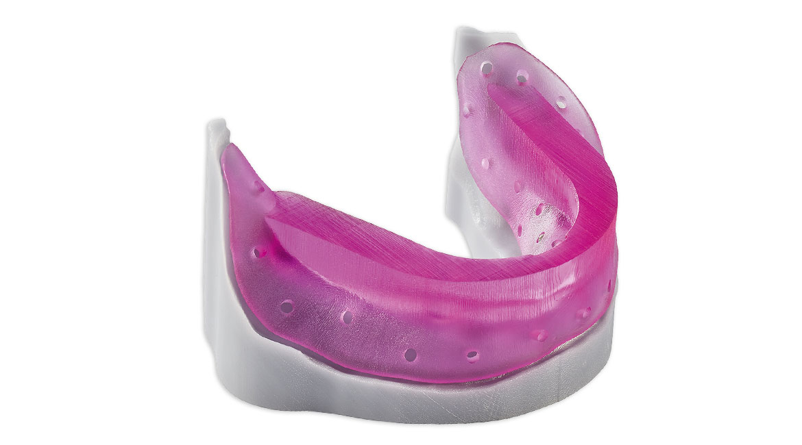 3D-gedruckter Abdrucklöffel aus M-PRINT Tray
