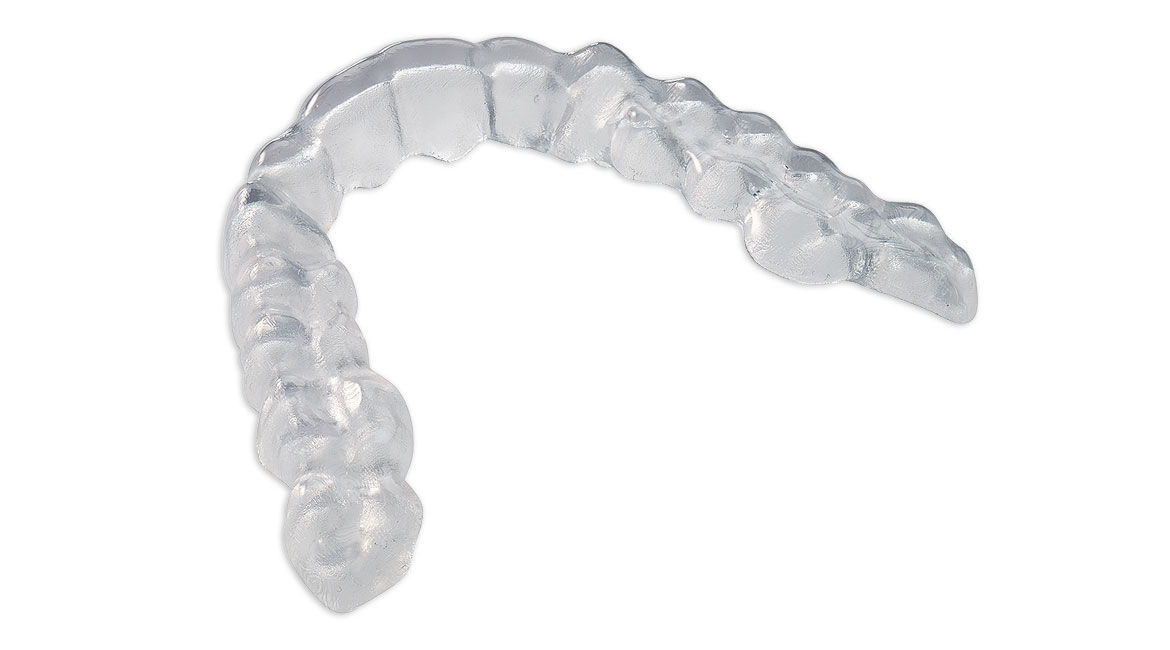 3D-gedruckte Aufbissschiene aus M-PRINT Splint