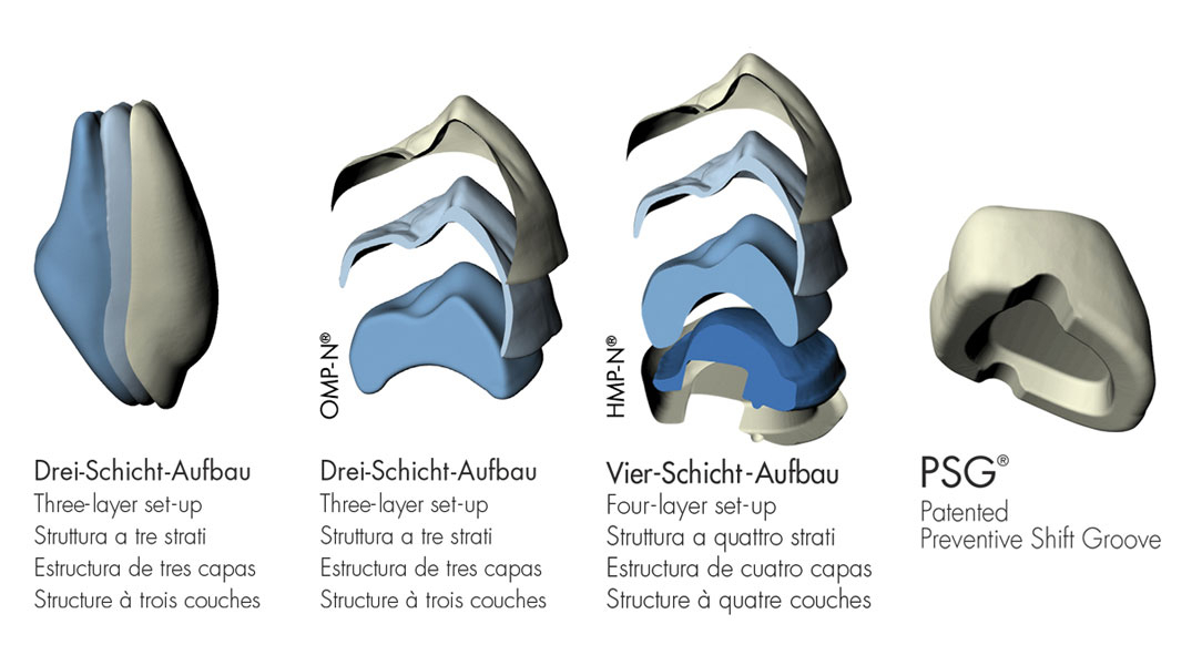 Schichtschema für den DeltaForm Front- und Seitenzahn